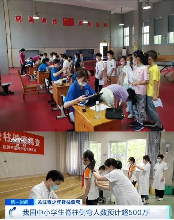 学校开展脊柱侧弯检查